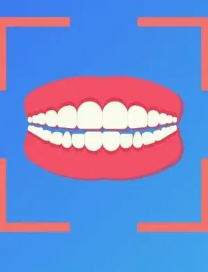 Scan My Teeth screenshot 5